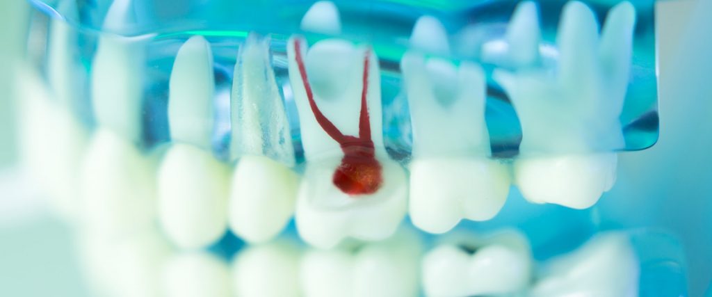 Endodoncia Main