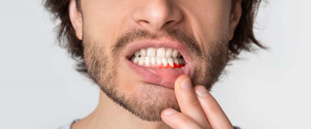 Periodoncia Main